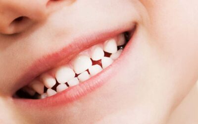 Are Dental X-Rays Safe For My Child?